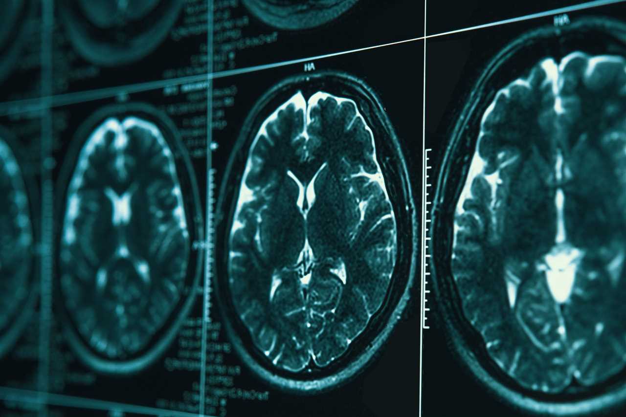 دانشجوی دکتری در دستگاه MRI هنگام تماشای سریال Friends برای پژوهش مغزی